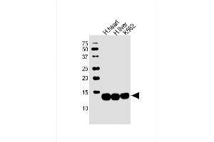All lanes : Anti-HBB Antibody (C-term) at 1:2000 dilution Lane 1: human heart lysate Lane 2: human liver lysate Lane 3: K562 whole cell lysate Lysates/proteins at 20 μg per lane. (Hemoglobin Subunit beta Antikörper  (C-Term))