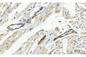 IHC analysis of MT-ND5 using anti-MT-ND5 antibody (ABIN7600145). (MT-ND5 Antikörper  (AA 154-570))