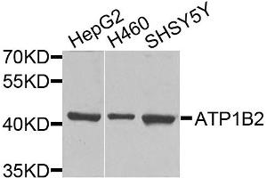 Western blot analysis of extracts of various cell lines, using ATP1B2 antibody. (ATP1B2 Antikörper)