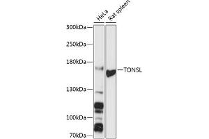 Western blot analysis of extracts of various cell lines, using TONSL antibody (ABIN6132818, ABIN6149388, ABIN6149389 and ABIN6216872) at 1:3000 dilution. (NFKBIL2 Antikörper  (AA 160-390))