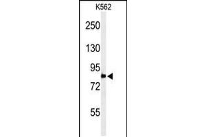 Western blot analysis of PLA2G4B Antibody in K562 cell line lysates (35ug/lane) (PLA2G4B Antikörper  (AA 396-424))