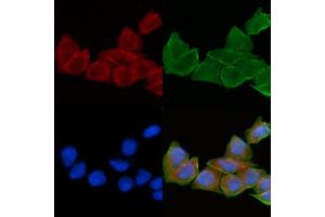 ABIN6258910 and ABIN6275186 staining Hela cells(30 min of UV treatment) by IF/ICC. (HLA-DOA Antikörper  (N-Term))