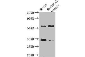 Western Blot Positive WB detected in: Mouse brain tissue, Mouse skeletal muscle tissue All lanes: VTN antibody at 2.
