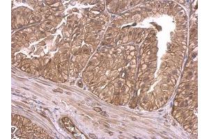 IHC-P Image Insulin Receptor antibody detects Insulin Receptor protein at membrane on mouse prostate by immunohistochemical analysis. (Insulin Receptor Antikörper  (C-Term))
