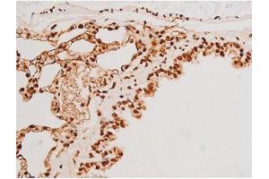 Immunohistochemistry (IHC) image for anti-Spleen tyrosine Kinase (SYK) (pTyr348) antibody (ABIN6255895)