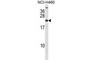 Western Blotting (WB) image for anti-Ribosomal Protein S16 (RPS16) antibody (ABIN2998333) (RPS16 Antikörper)