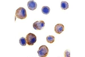 Immunohistochemistry (IHC) image for anti-Tumor Necrosis Factor Receptor Superfamily, Member 10b (TNFRSF10B) (C-Term) antibody (ABIN1030367)