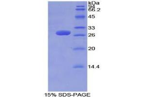 SDS-PAGE analysis of Mouse Tubulin delta Protein. (TUBD1 Protein)