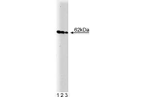 Western Blotting (WB) image for anti-V-Yes-1 Yamaguchi Sarcoma Viral Oncogene Homolog 1 (YES1) (AA 10-193) antibody (ABIN967927) (YES1 Antikörper  (AA 10-193))