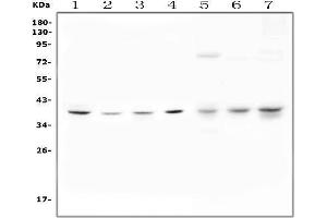 Western blot analysis of Unrip using anti-Unrip antibody (ABIN3043302).