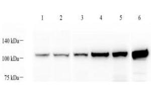 Western blot analysis of alpha Actinin (ABIN7073023) at dilution of 1: 1000,Lane 1: MCF7 cell lysate,Lane 2: Hela cell lysate,Lane 3: Mouse spleen tissue lysate,Lane 4: Mouse skeletal muscle tissue lysate,Lane 5: Mouse heart tissue lysate,Lane 6: Rat skeletal muscle tissue lysate