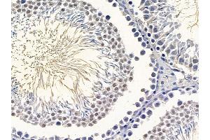 ABIN6265350 and ABIN6266871 at 1/100 staining rat testis tissue by IHC-P. (STRADA Antikörper  (Internal Region))