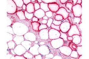 Immunohistochemistry (IHC) image for anti-Nuclear Receptor Subfamily 5, Group A, Member 2 (NR5A2) (C-Term) antibody (ABIN1049146)
