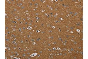 The image on the left is immunohistochemistry of paraffin-embedded Human brain tissue using ABIN7191878(PIK3CD Antibody) at dilution 1/20, on the right is treated with synthetic peptide. (PIK3CD Antikörper)