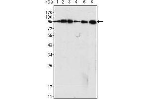 Western blot analysis using Dynamin1 mouse mAb against C6 (1), NIH/3T3 (2), SKN-SH (3), LN18 (4), SHSY5Y (5) cell lysate and rat brain tiisues lysate (6). (Dynamin 1 Antikörper)