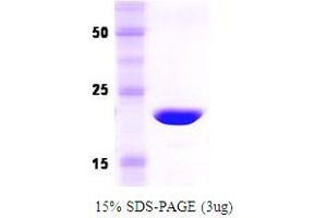 SDS-PAGE (SDS) image for Recoverin (RCVRN) protein (ABIN666850) (Recoverin Protein (RCVRN))