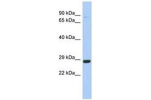 Image no. 1 for anti-Chromosome 21 Open Reading Frame 91 (C21orf91) (AA 71-120) antibody (ABIN6743397) (C21orf91 Antikörper  (AA 71-120))