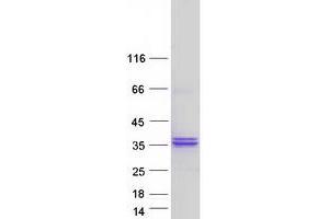 Western Blotting (WB) image for Ribose 5-Phosphate Isomerase A (RPIA) protein (Myc-DYKDDDDK Tag) (ABIN2731120)