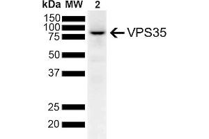 Western Blot analysis of Human SH-SY5Y lysates showing detection of 91. (VPS35 Antikörper  (Atto 594))