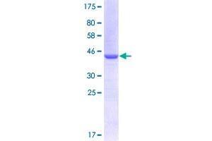 UNC5B Protein (AA 27-126) (GST tag)