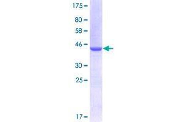 UNC5B Protein (AA 27-126) (GST tag)