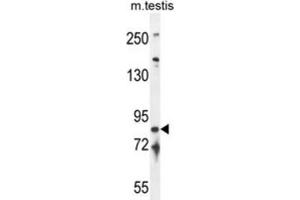 Western Blotting (WB) image for anti-Intraflagellar Transport 81 Homolog (IFT81) antibody (ABIN2995688) (IFT81 Antikörper)