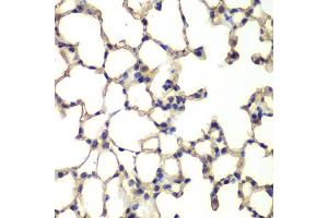 Immunohistochemistry of paraffin-embedded mouse lung using MAPK14 antibody (ABIN5998182) at dilution of 1/100 (40x lens). (MAPK14 Antikörper)