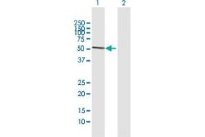 Western Blot analysis of ATG16L1 expression in transfected 293T cell line by ATG16L1 MaxPab polyclonal antibody. (ATG16L1 Antikörper  (AA 1-523))