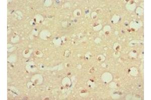 Immunohistochemistry of paraffin-embedded human brain tissue using ABIN7166082 at dilution of 1:100 (40S Ribosomal Protein S3-B (RPS3.S) (AA 1-92) Antikörper)