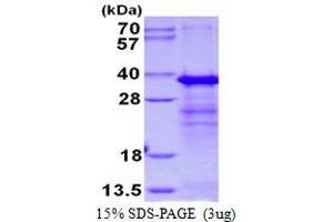 Image no. 1 for SERTA Domain Containing 1 (SERTAD1) protein (His tag) (ABIN1098643) (SERTAD1 Protein (His tag))