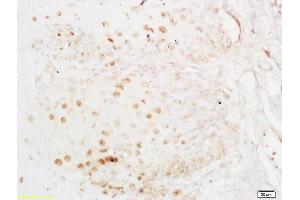 Immunohistochemistry (IHC) image for anti-ELAV (Embryonic Lethal, Abnormal Vision, Drosophila)-Like 1 (Hu Antigen R) (ELAVL1) antibody (ABIN748583)