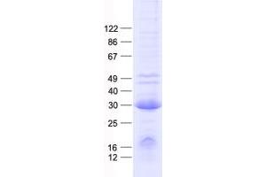 Validation with Western Blot (MED6 Protein (His tag))