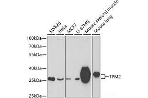 Western blot analysis of extracts of various cell lines using TPM2 Polyclonal Antibody at dilution of 1:400. (TPM2 Antikörper)