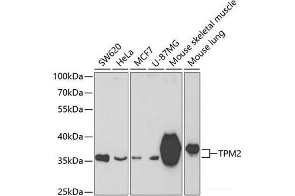 TPM2 anticorps