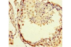 Immunohistochemistry of paraffin-embedded human testis tissue using ABIN7167648 at dilution of 1:100 (RTEL1 Antikörper  (AA 975-1219))