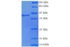 SDS-PAGE (SDS) image for FK506 Binding Protein 3, 25kDa (FKBP3) (AA 2-224) protein (His-SUMO Tag) (ABIN5709529)