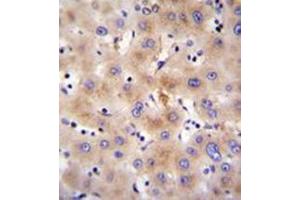 Immunohistochemistry analysis in formalin fixed and paraffin embedded human liver tissue reacted with FBXO47 Antibody (N-term) followed by peroxidase conjugation of the secondary antibody and DAB staining. (FBXO47 Antikörper  (N-Term))