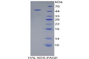 SDS-PAGE analysis of Human PSMC6 Protein. (PSMC6 Protein)
