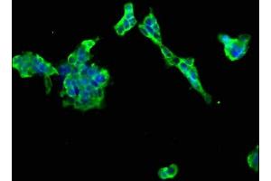 Immunofluorescence staining of 293 cells with ABIN7165907 at 1:66, counter-stained with DAPI. (Patched 2 Antikörper  (AA 793-951))