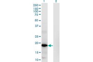 Western Blot analysis of RNASEH2C expression in transfected 293T cell line by RNASEH2C monoclonal antibody (M02), clone 5D6. (RNASEH2C Antikörper  (AA 1-164))