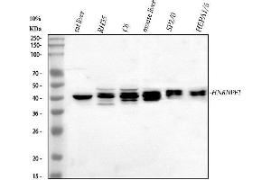 Western blot analysis of HnRNPF using anti-HnRNPF antibody (ABIN4886622). (HNRNPF Antikörper  (N-Term))