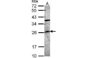 WB Image Sample (30 ug of whole cell lysate) A: A549 12% SDS PAGE antibody diluted at 1:1000 (GRAP Antikörper  (C-Term))
