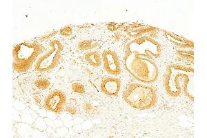 ABIN6260660 and ABIN6268685 at 1/100 staining Human normal tissues adjacent to breast cancer by IHC-P. (CD9 Antikörper  (Internal Region))