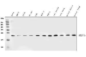 Western blot analysis of RAB7 using anti-RAB7 antibody (ABIN3044538).