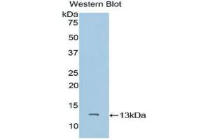 Western blot analysis of the recombinant protein. (CD59 Antikörper  (AA 26-98))