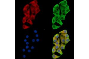 ABIN7096320 and ABIN7100382 staining Hela cells by IF/ICC. (Calpain 8 Antikörper)