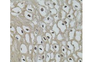Immunohistochemistry of paraffin-embedded Human esophagus using IL33 Polyclonal Antibody (IL-33 Antikörper)