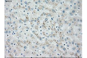 Immunohistochemical staining of paraffin-embedded Ovary tissue using anti-CHEK2mouse monoclonal antibody. (CHEK2 Antikörper)