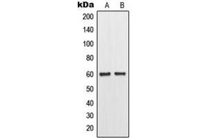 Western blot analysis of MMP11 expression in MCF7 (A), Raw264. (MMP11 Antikörper  (Center))