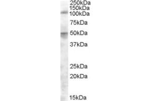 Image no. 1 for anti-Endoplasmic Reticulum Aminopeptidase 2 (ERAP2) (Internal Region) antibody (ABIN374998) (ERAP2 Antikörper  (Internal Region))